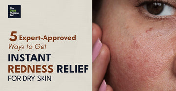 5 Expert-Approved Ways to Get Instant Redness Relief for Dry Skin