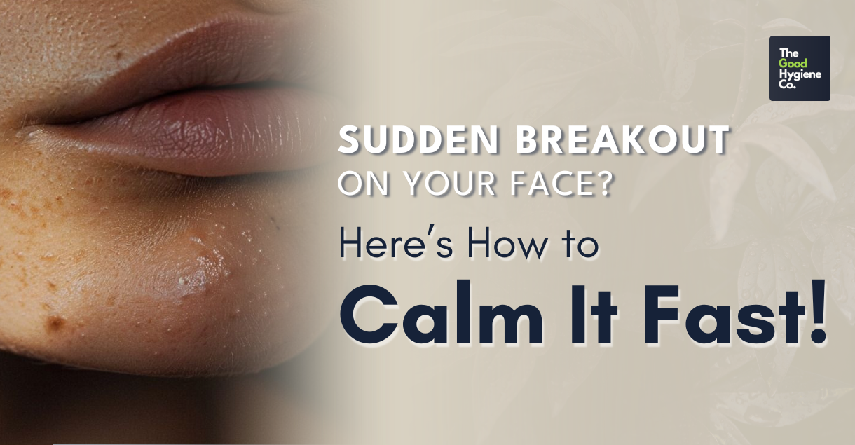 Sudden Breakout on Your Face? Here’s How to Calm It Fast