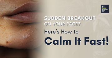Sudden Breakout on Your Face? Here’s How to Calm It Fast