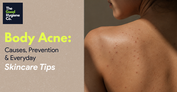 Body Acne: Causes, Prevention & Everyday Skincare Tips