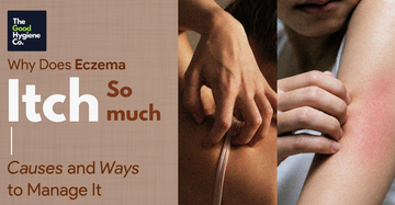 Why Does Eczema Itch So Much? Causes and Ways to Manage It