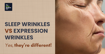 Sleep wrinkles vs. expression wrinkles – yes, they’re different!