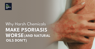 Why Harsh Chemicals Make Psoriasis Worse (and Natural Oils Do Not)