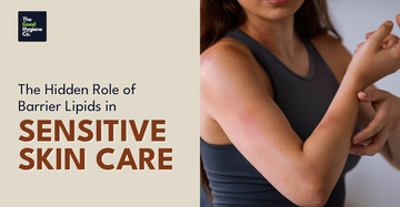 The Hidden Role of Barrier Lipids in Sensitive Skin Care 