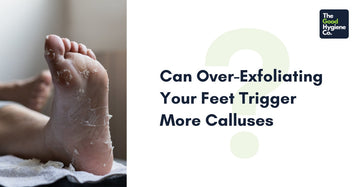 Can Over-Exfoliating Your Feet Trigger More Calluses?