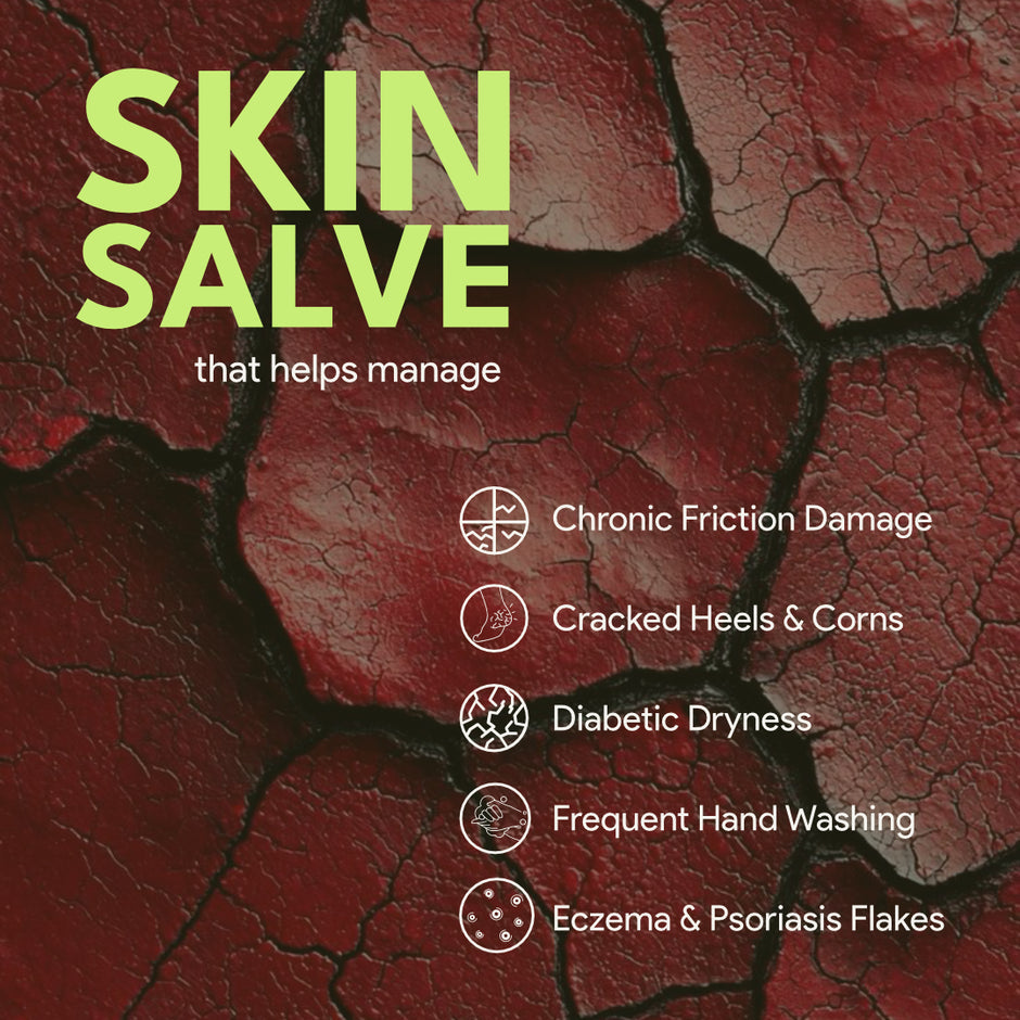 The Good Barrier Restore Skin Salve: A Soothing Moisturising Cream for Sensitive Skin