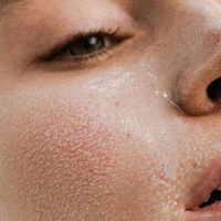 Dry, Dehydrated Skin