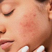 Everyday Redness