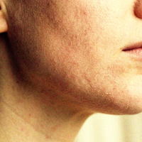Dull, Tired Skin