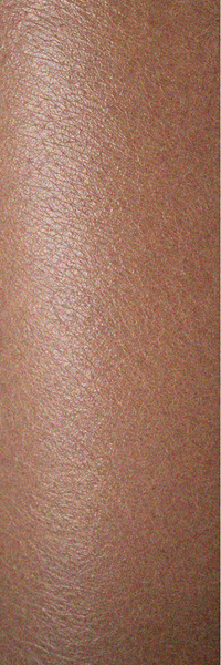Day 1 dry skin before using body butter