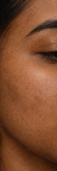 Close-up of cheek skin showing visible texture, enlarged pores, and mild unevenness.