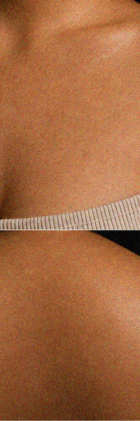Day 30 sensitive skin after using body rinse