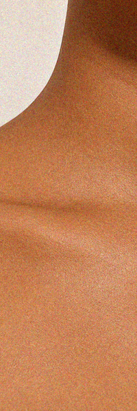 Day 30 skin close-up for sensitive skin