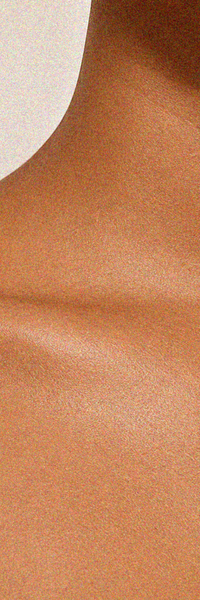 Day 45 skin close-up for sensitive skin