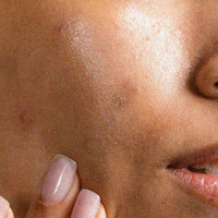 Greasy, Heavy Moisturizers